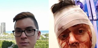 Spate Of Gay Hate Crimes Concerning for Officials in Dallas Geoffrey Hubbard, who told WFAA he was beaten and robbed in the neighborhood in November.- Source: Facebook