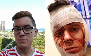 Spate Of Gay Hate Crimes Concerning for Officials in Dallas Geoffrey Hubbard, who told WFAA he was beaten and robbed in the neighborhood in November.- Source: Facebook