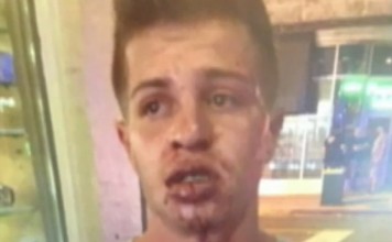 Gay Hate Crime Attack in Miami After Sharing a Kiss