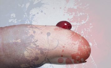 Progress Made Towards Ending Gay Blood Donation Ban In France Blood Ban France