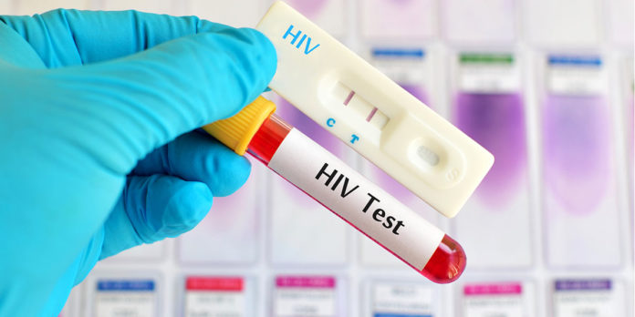 HIV diagnoses